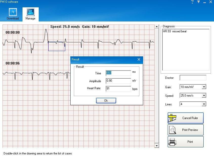 PM10 PALM ECG with Software and Bluetooth Medische Vakhandel