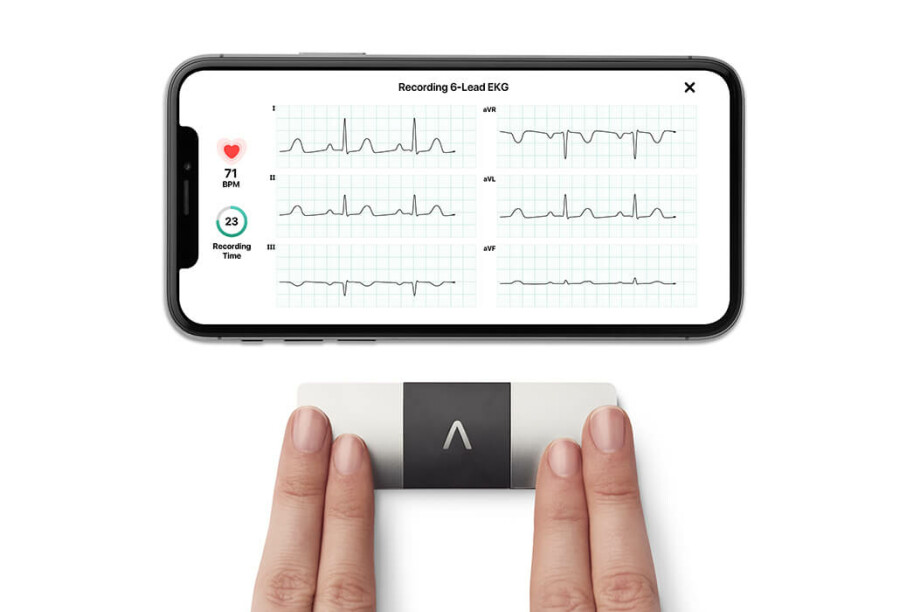 AliveCor KardiaMobile 6L Unboxing and First impressions